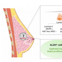 影響因子12.31！中國專家提出乳腺癌腫瘤干細(xì)胞治療開拓性研究視角